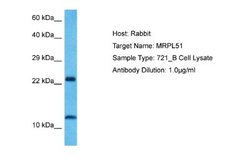 MRPL51 Rabbit anti-Human, Polyclonal, Novus Biologicals 0.1ml; Unconjugated:Antibodies,
